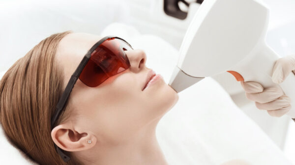 epilare-definitiva-barbie