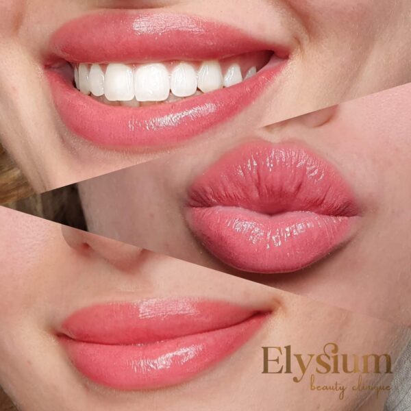 tratamente-faciale-buze